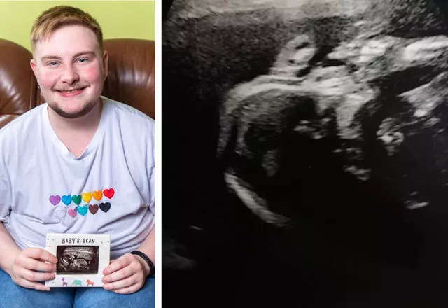 Haber | mkansz sanyordu! Hamile kalan adam oke eden gebelik srecini sosyal medyadan paylat